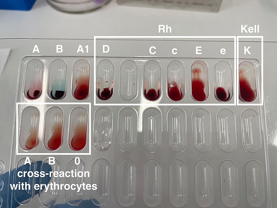 Pruebas de tipificación sanguínea ABO, Rh y Kell sobre placa de laboratorio